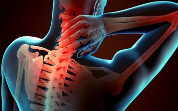 dolori alla cervicale sintomi