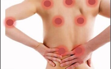 fibromialgia