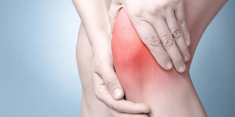 artrosi al ginocchio